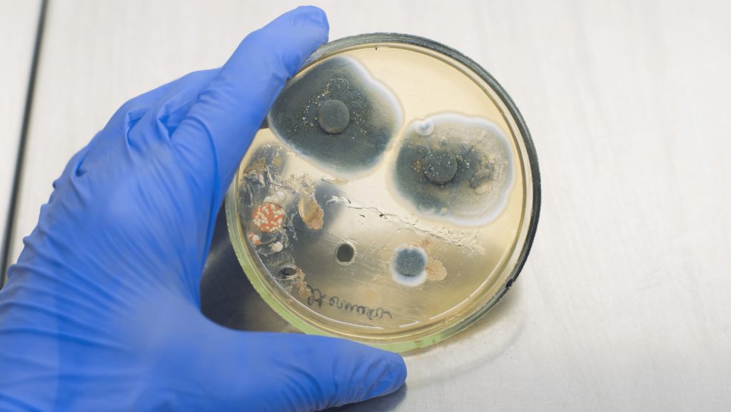 Why Do I Need Mold Testing in My Property?